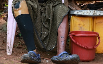 A Myanmar's farmerm Hla Han, lost his leg after stepping on a mine in eastern Kayah state